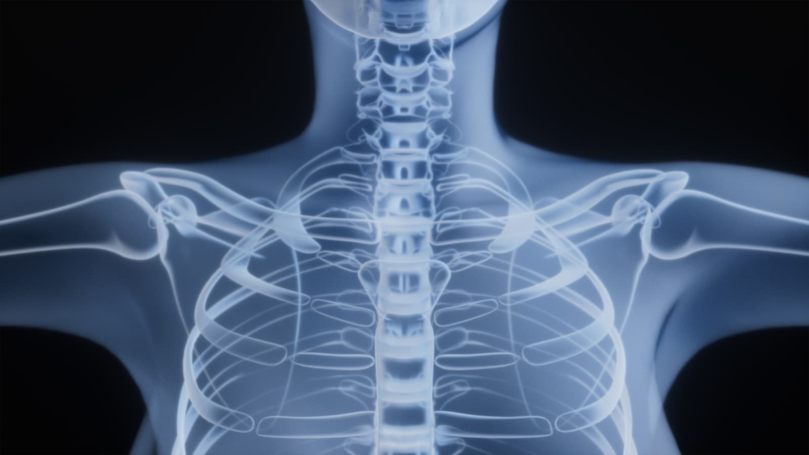 Spine and torso X-ray